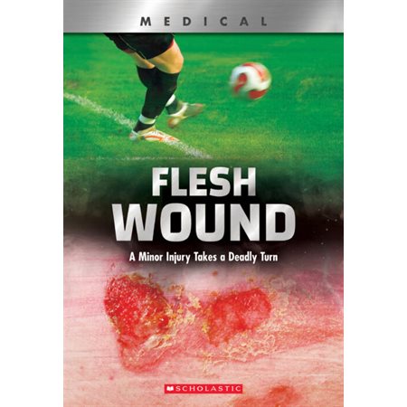 Medica l: Flesh Wound : Anglais : Paperback : Souple