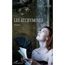 Ecchymoses Les
